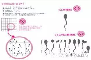 二胎,你又意外怀孕了怎么办?-怀孕期