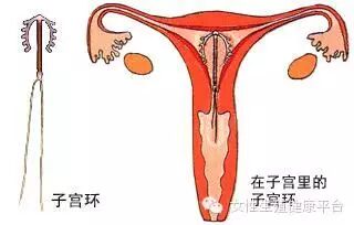 [网商爱华】子宫与健康----女人为了自己请收藏与分享！！ - 爱华 - 【网商爱华】王爱华老师