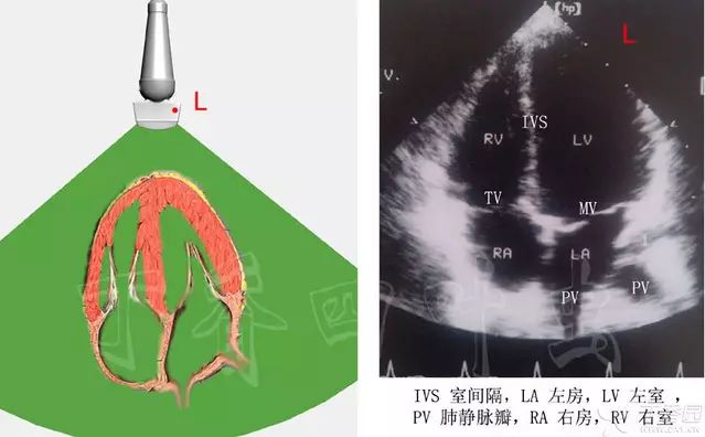 心尖的四腔切面是最重要的标准切面之一,这里可以评价心脏四个心腔