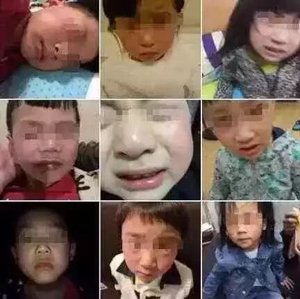 学校误开紫外灯致20个孩子眼灼伤，安全用灯需注意哪些？