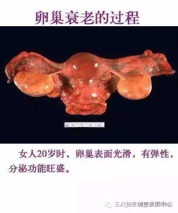 卵巢—掌控女人一生的兴衰!三八妇乐招商微15710509618