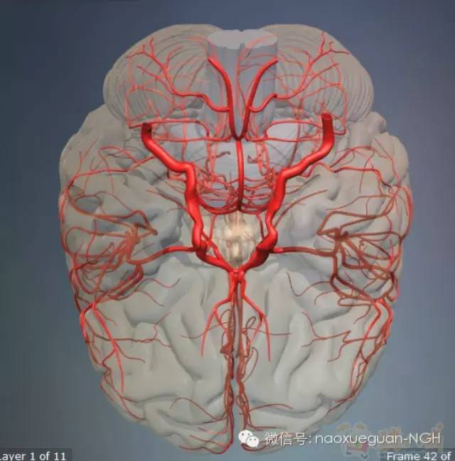 脑血管病检查知多少一