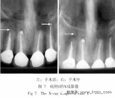 1421200141958317.jpg