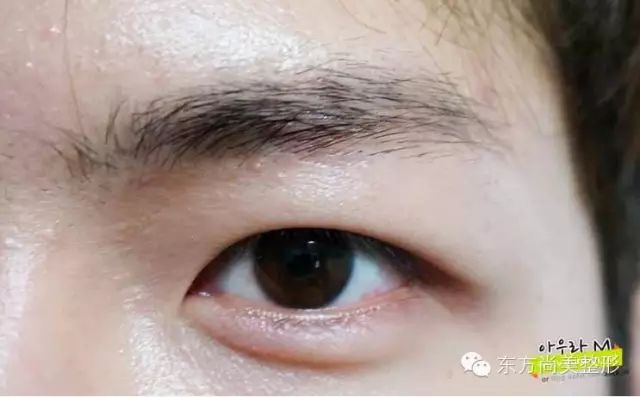 长春东方尚美,让您无需出国,即可在长春享受来自韩国的顶级纹绣技术。拒绝韩式,因为一切源于韩国,取材韩国,专家来自韩国!9月3日,东方尚美韩国纹绣火热预约中。 韩国著名纹绣专家申智允 长春东方尚美整形医院特邀韩国顶级的纹绣老师,以精湛的纹绣技术、热情的服务,真诚的态度打造更完美、自信的你! 一双动人心魄会说话的眼睛总会给人留下深刻的印象,然而传统的化妆与卸妆往往会耗费大量的时间。东方尚美特邀韩国著名专家亲自操作韩国最流行的、最受明星欢迎的半永久纹绣项目!让你从此成为真正的裸妆美人! 韩国半永久化妆术