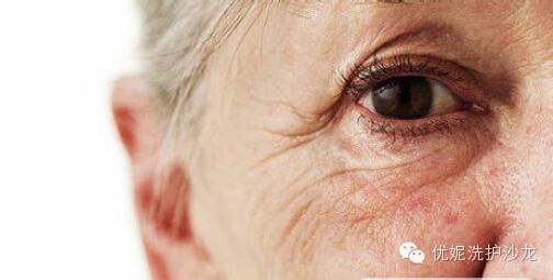 头皮衰老会让你看起来比实际年龄老6岁！