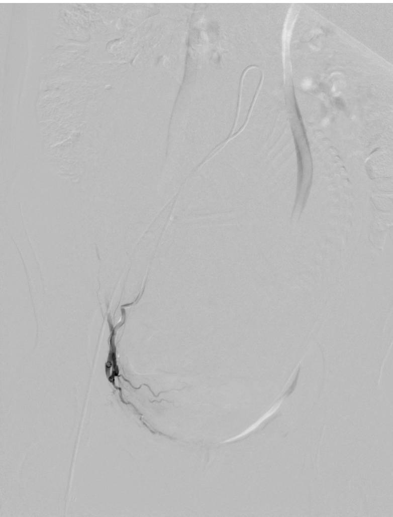 怀孕7月胎儿夭折,原因却是因为……-怀孕期