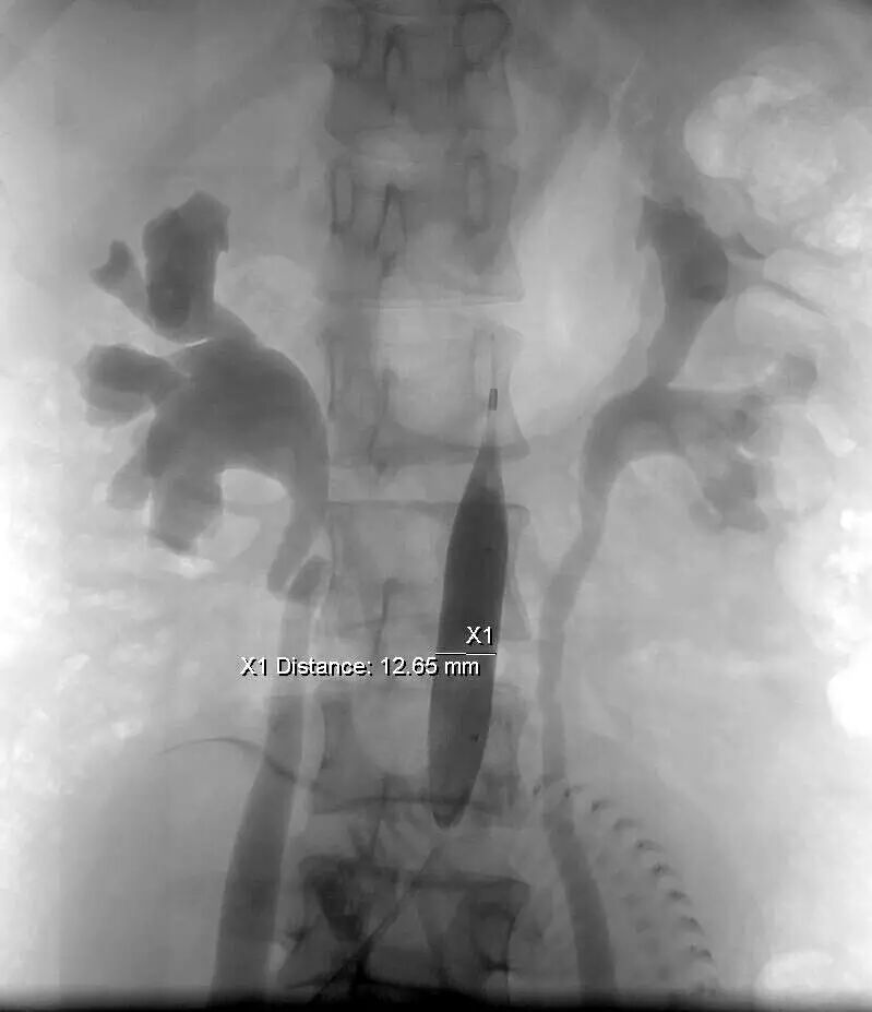 怀孕7月胎儿夭折,原因却是因为……-怀孕期