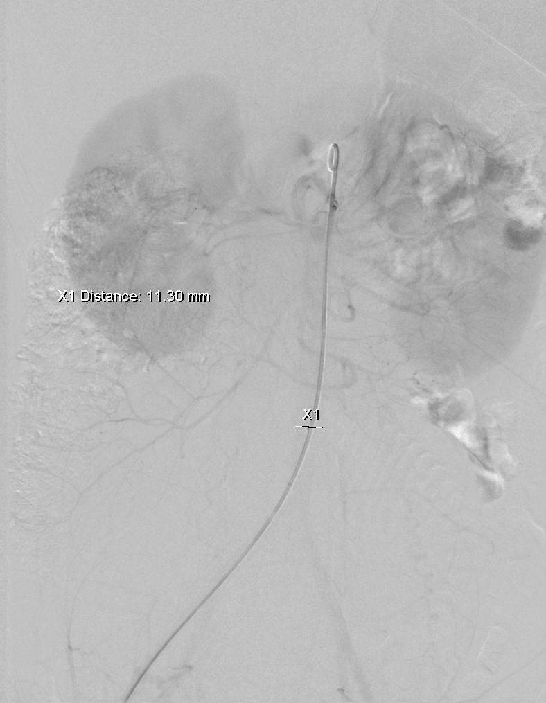 怀孕7月胎儿夭折,原因却是因为……-怀孕期