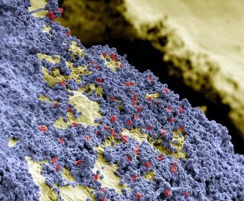 看过放大1000倍的牙齿，你肯定会好好刷牙了