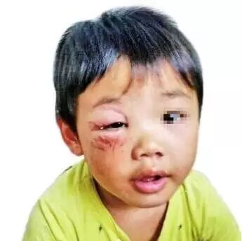 【医生爱八卦】 男人怀孕生子了,男人操的心还不止这些!-怀孕期