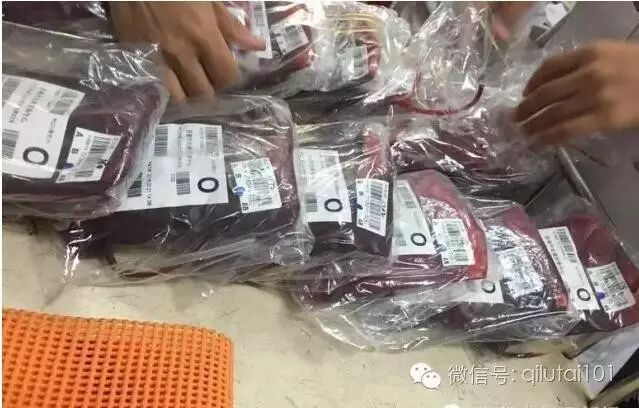 【紧急追踪】二胎产妇大出血,昏迷13天,全城献血!医生:怀疑是羊水栓塞!急需O型血-怀孕期