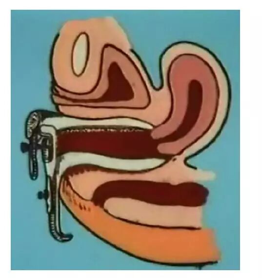 妇科器械怎么使用妇产科常见手术器械大盘点_https://www.jmylbn.com_新闻资讯_第15张