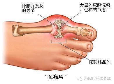 澳门发现“痛风”千年秘方! - 金鑫 - 金鑫的博客 澳门发现“痛风”千年秘方! - 渔夫 - 渔夫 博客