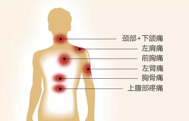 后背痛也值得注意当身体出现这些部位的单一疼痛或并发疼痛时,一定要