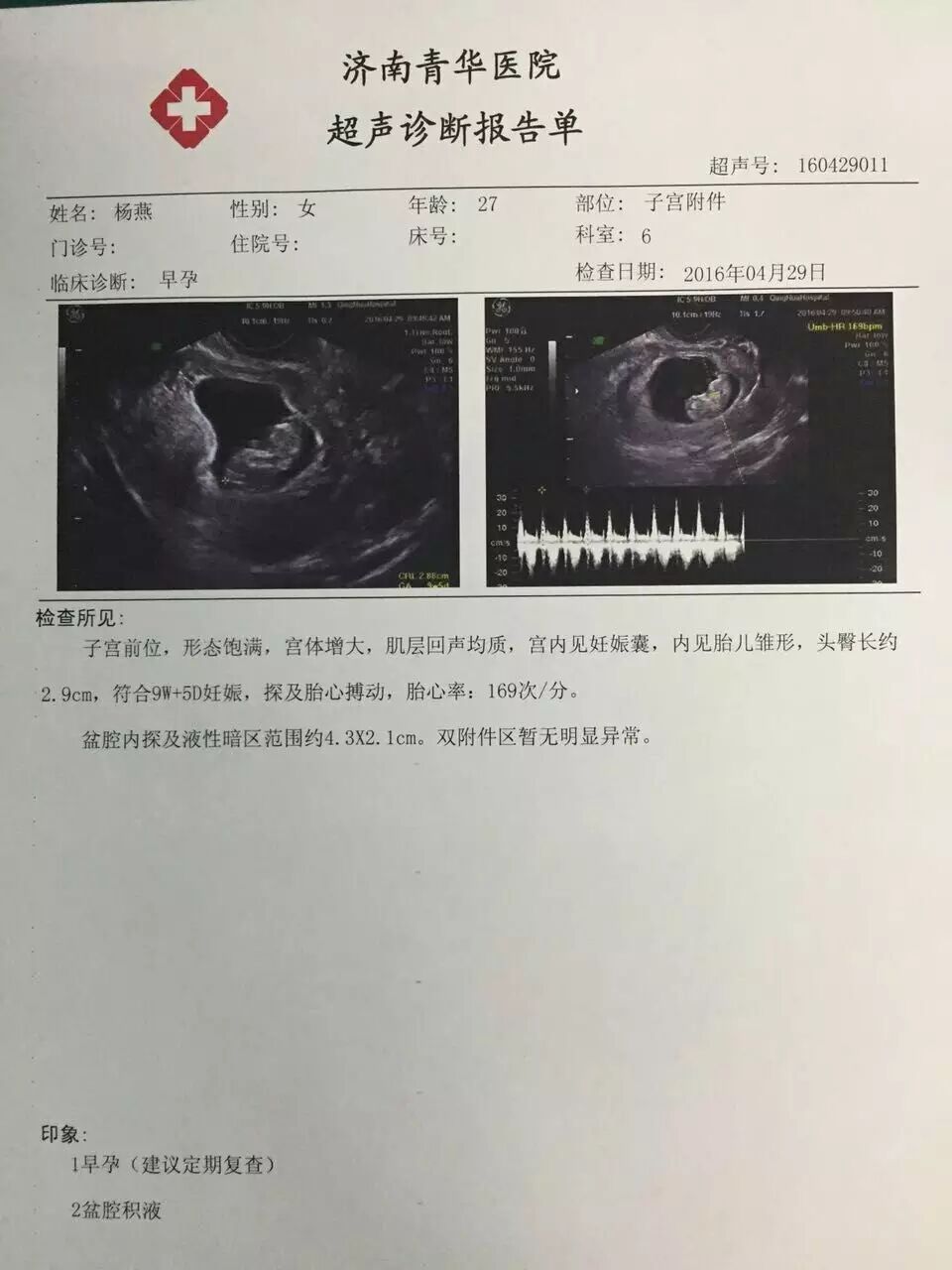 B超室传喜讯:双子宫导致月经回流形成子宫内膜异位症的青华妈妈杨燕怀孕9w啦!&“91年”小夫妻携一胎儿子报喜 欲求二胎-怀孕期
