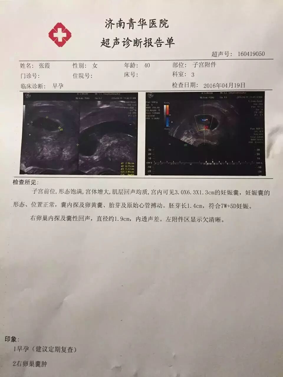 喜事连连:宫外孕切除右侧输卵管的38岁妈妈携“100天青华宝宝”报喜啦! 两次流产的40岁患者怀孕54天啦!-怀孕期