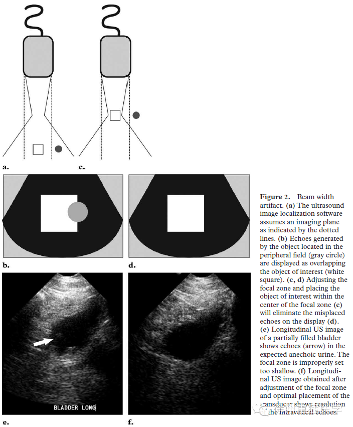 彩超伪像是什么超声伪像 丨US Artifacts_https://www.jmylbn.com_新闻资讯_第3张