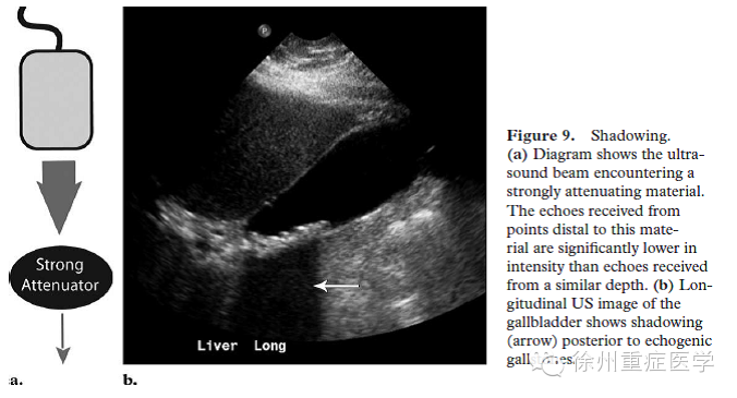 彩超伪像是什么超声伪像 丨US Artifacts_https://www.jmylbn.com_新闻资讯_第11张