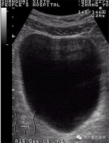 彩超伪像是什么超声伪像 丨US Artifacts_https://www.jmylbn.com_新闻资讯_第5张