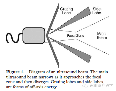 彩超伪像是什么超声伪像 丨US Artifacts_https://www.jmylbn.com_新闻资讯_第2张