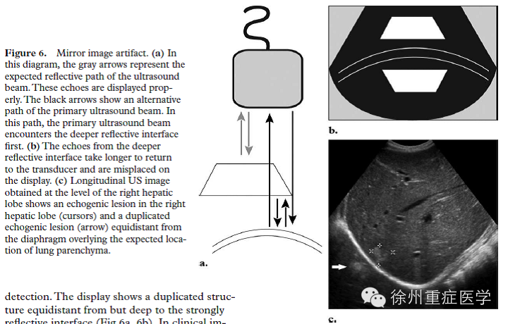 彩超伪像是什么超声伪像 丨US Artifacts_https://www.jmylbn.com_新闻资讯_第8张