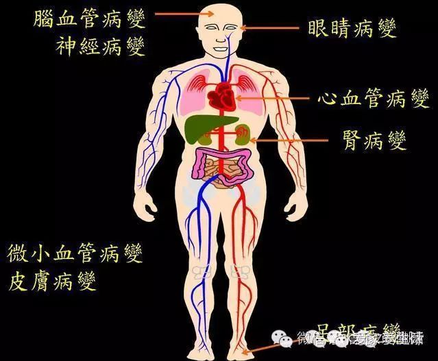 糖尿病根源在这里，不要让西医害了您！！转起！