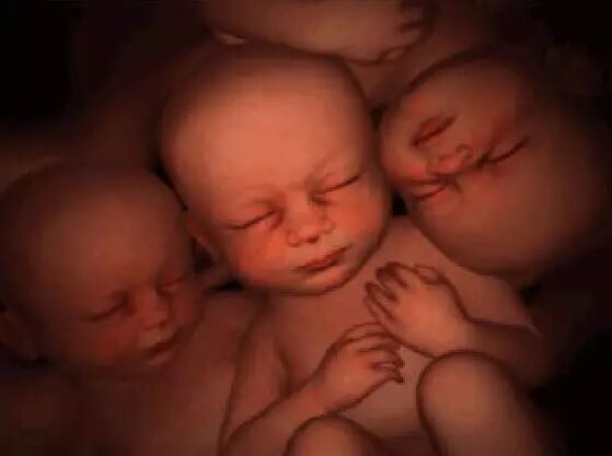 弥勒一夫妻:第二胎生3胞(第一胎生1个)-怀孕期