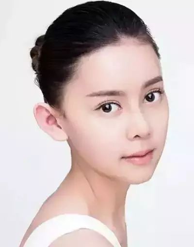 她花了100万整形,从丑小鸭整到Angelababy!