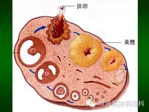 一起来了解多囊卵巢综合征和卵巢过度刺激综合征