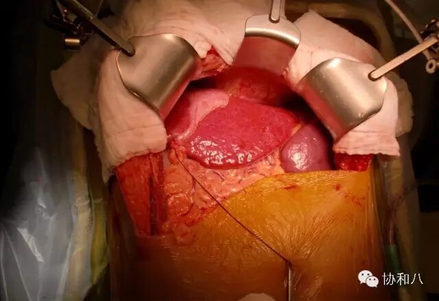 弯组织剪怎么拿组织剪能剪线吗？那些常被忽略的错误操作_https://www.jmylbn.com_新闻资讯_第7张