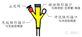 三腔导尿管怎么使用拔尿管一定先抽水囊啊同学丨一页手册·协和八_https://www.jmylbn.com_新闻资讯_第2张