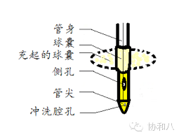 三腔导尿管怎么使用拔尿管一定先抽水囊啊同学丨一页手册·协和八_https://www.jmylbn.com_新闻资讯_第4张
