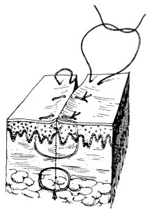 为什么要用皮钉缝合洛阳亲友如相问，就说我在练缝皮 ｜ 一页手册·协和八_https://www.jmylbn.com_新闻资讯_第2张