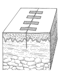 为什么要用皮钉缝合洛阳亲友如相问，就说我在练缝皮 ｜ 一页手册·协和八_https://www.jmylbn.com_新闻资讯_第9张