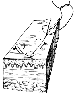 为什么要用皮钉缝合洛阳亲友如相问，就说我在练缝皮 ｜ 一页手册·协和八_https://www.jmylbn.com_新闻资讯_第5张