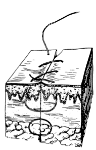 为什么要用皮钉缝合洛阳亲友如相问，就说我在练缝皮 ｜ 一页手册·协和八_https://www.jmylbn.com_新闻资讯_第7张