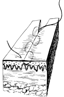 为什么要用皮钉缝合洛阳亲友如相问，就说我在练缝皮 ｜ 一页手册·协和八_https://www.jmylbn.com_新闻资讯_第4张