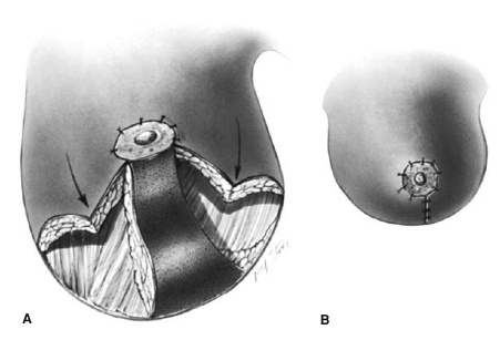为什么要用皮钉缝合洛阳亲友如相问，就说我在练缝皮 ｜ 一页手册·协和八_https://www.jmylbn.com_新闻资讯_第6张