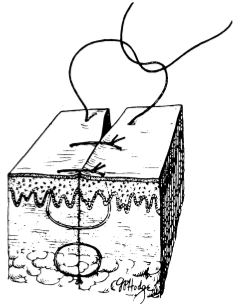 为什么要用皮钉缝合洛阳亲友如相问，就说我在练缝皮 ｜ 一页手册·协和八_https://www.jmylbn.com_新闻资讯_第1张