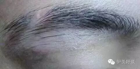 纹的眉毛变红财运不好_眉毛财运线_眉毛纹的变成红色了怎么能去掉