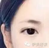 眉毛财运线_眉毛纹的变成红色了怎么能去掉_纹的眉毛变红财运不好