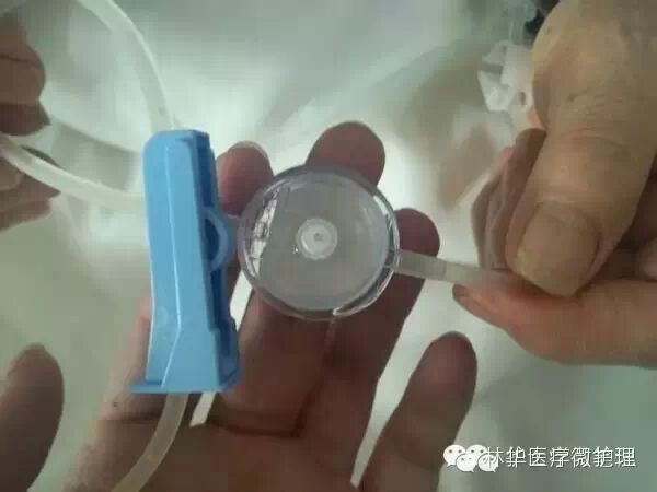 怎么调节输液器输液管有空气？四种排气方法介绍给你_https://www.jmylbn.com_新闻资讯_第3张