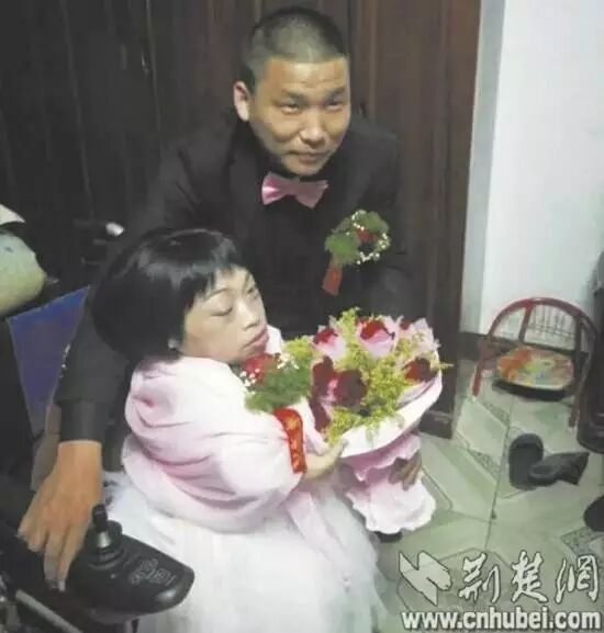 89厘米袖珍“瓷娃娃” 怀孕后勇敢决定当妈-怀孕期