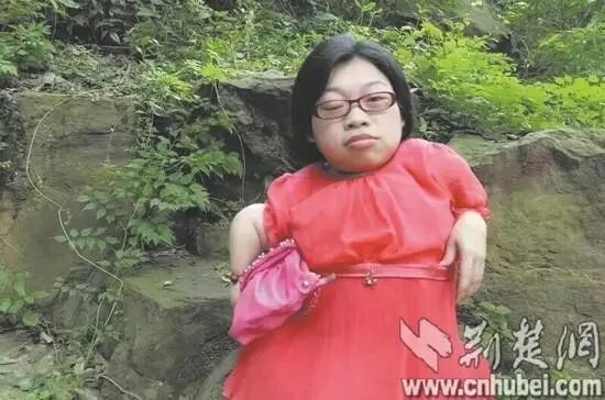 89厘米袖珍“瓷娃娃” 怀孕后勇敢决定当妈-怀孕期