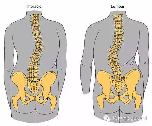 脊柱侧弯42问(很全的问题汇总,赶快收藏吧)