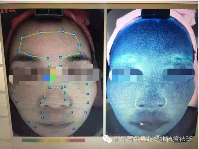 铅汞中毒与死亡:女人为美丽付出昂贵的代价【保定重金属开采联盟】