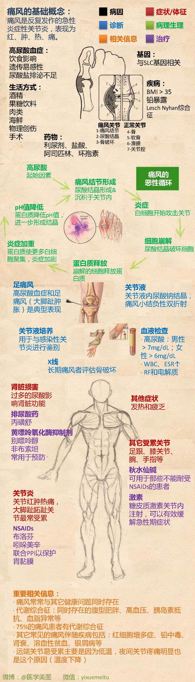一图读懂—痛风