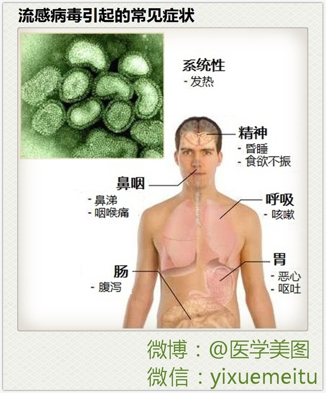 一图读懂—流感病毒引起的常见症状