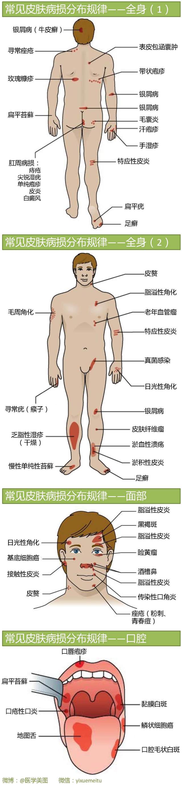 一图读懂—各种皮肤病好发部位