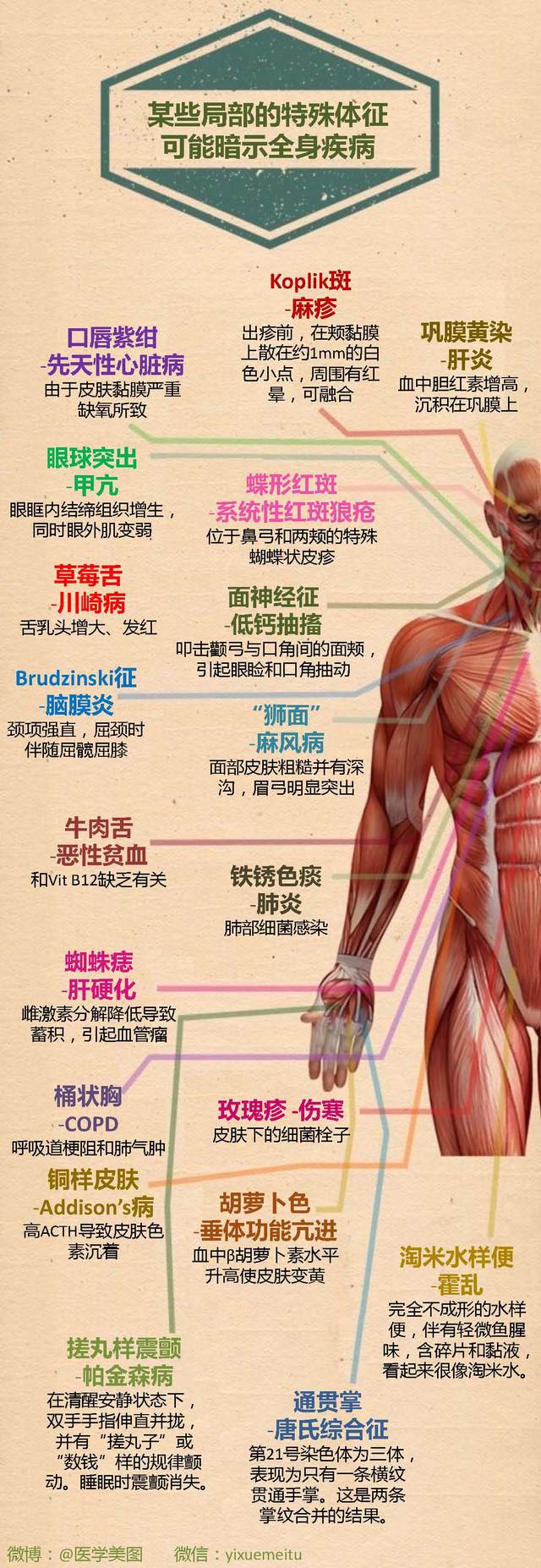 一图读懂—极具标志性的疾病体征